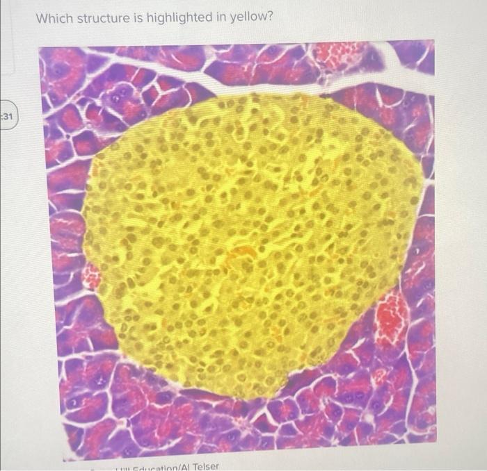 Which structure is highlighted cecum