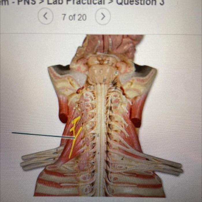 Which structure is highlighted cecum