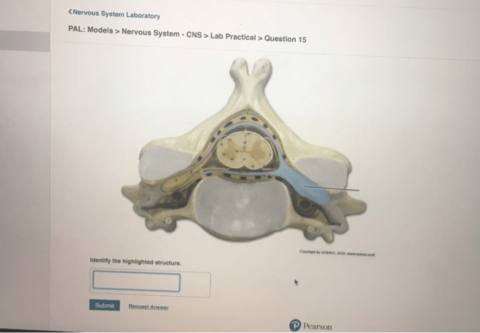 Pal models nervous system cns lab practical question 1